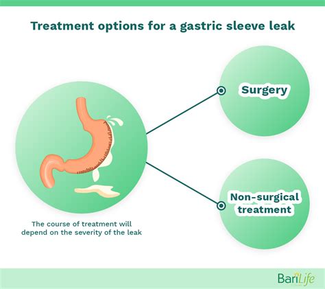 gastric sleeve leak|Gastric sleeve leak